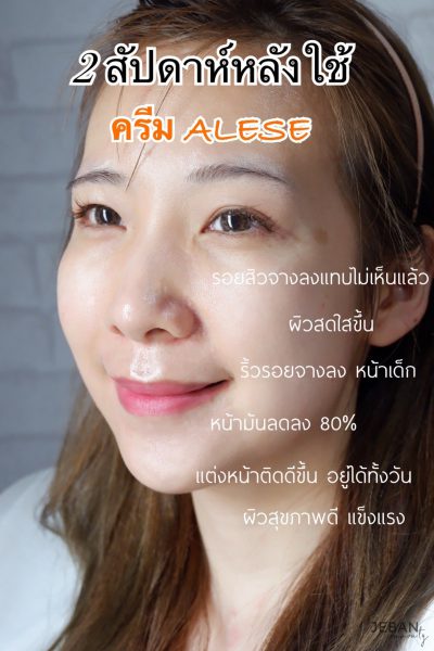 ALESE ครีมซอง 7-11