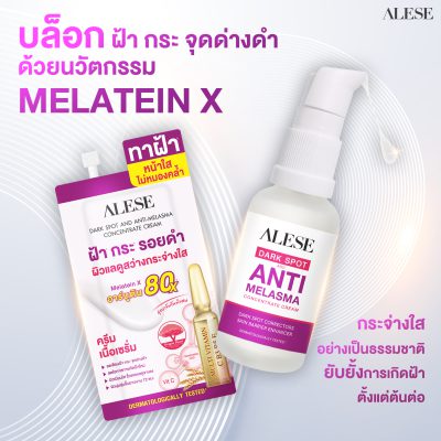ฝ้า เกิดจากอะไร ครีมทาฝ้า อะลิเซ่