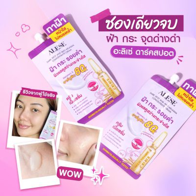 ฝ้า เกิดจากอะไร ครีมทาฝ้า อะลิเซ่
