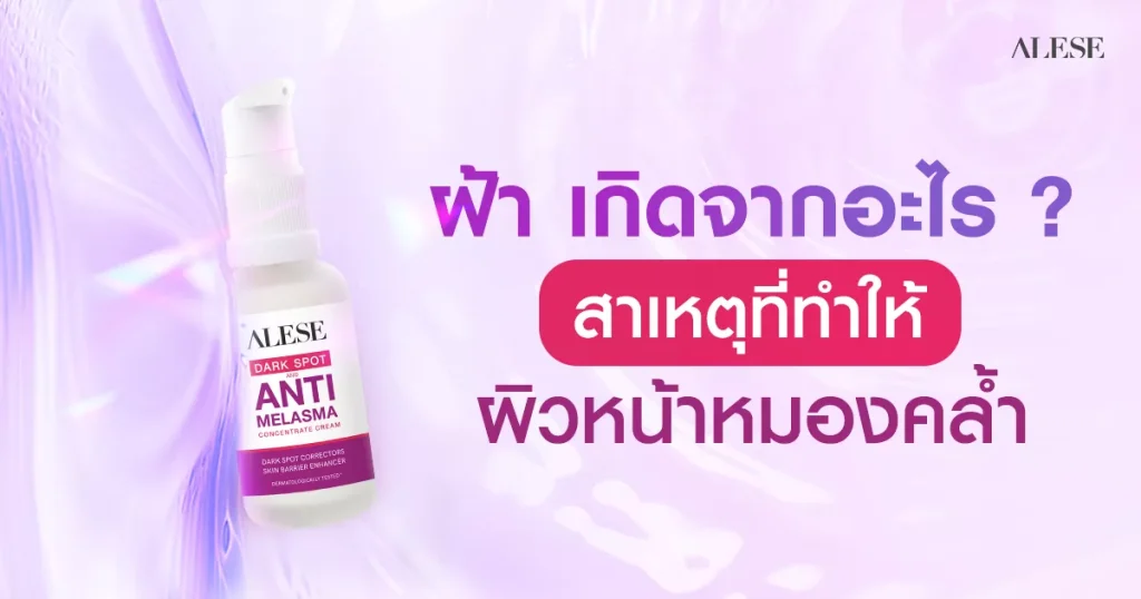 ฝ้า เกิดจากอะไร ทำความเข้าใจ พร้อมรับมือและป้องกันอย่างถูกวิธี