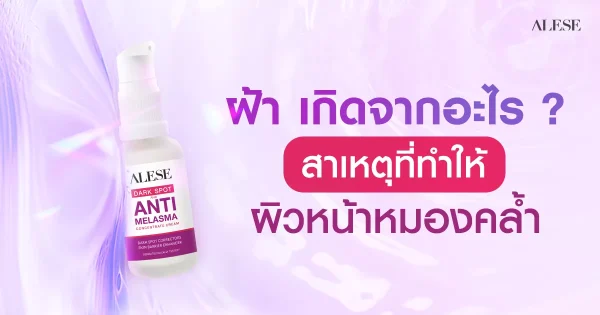ฝ้า เกิดจากอะไร ทำความเข้าใจ พร้อมรับมือและป้องกันอย่างถูกวิธี