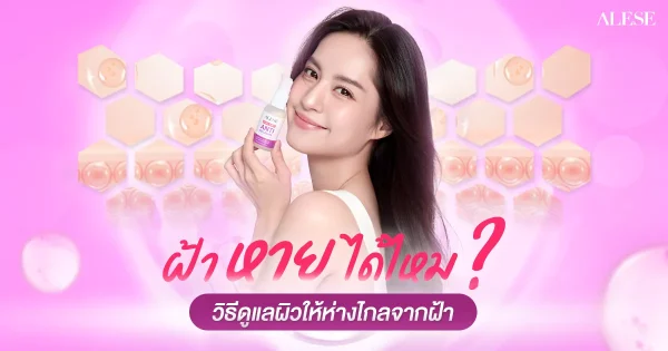 ฝ้าหายได้ไหม วิธีดูแลผิวให้ห่างไกลจากฝ้า