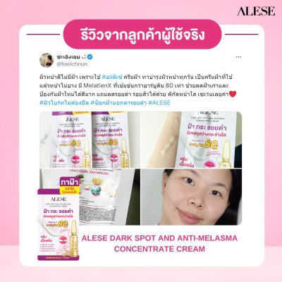 รีวิวครีมทาฝ้า