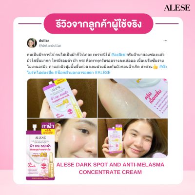 รีวิวครีมทาฝ้า
