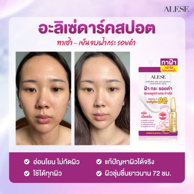 ครีมทาฝ้า อะลิเซ่ สูตรเข้มข้น
