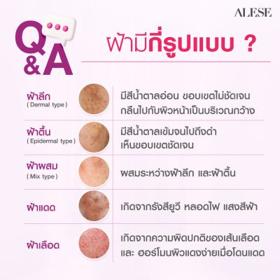 10 คำถาม