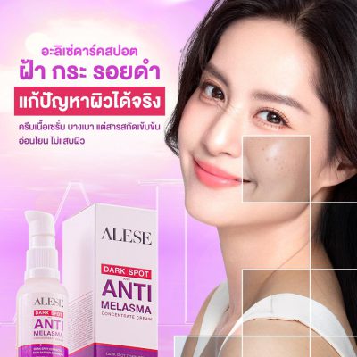 ครีมทาฝ้า อะลิเซ่
